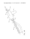 Therapeutic Cell Applicator Instrument with Modular Tips diagram and image