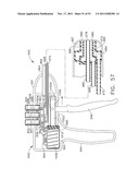 Therapeutic Cell Applicator Instrument with Modular Tips diagram and image