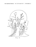 TREATMENT OF INDICATIONS USING ELECTRICAL STIMULATION diagram and image