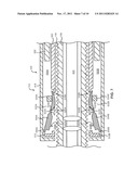 Catheter Handle and Methods of Operating diagram and image