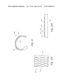 AXIALLY-RADIALLY NESTED EXPANDABLE DEVICE diagram and image