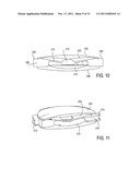 Accommodating Intraocular Lenses diagram and image