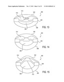 Accommodating Intraocular Lenses diagram and image