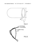 Accommodating Intraocular Lenses diagram and image