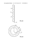 Accommodating Intraocular Lenses diagram and image