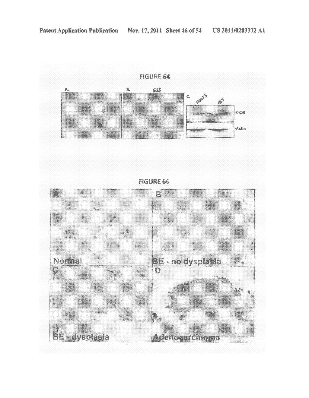 COMPOSITIONS USEFUL FOR CANCER DETECTION AND TREATMENT, A CANCER STEM CELL     MODEL, AND METHODS OF PRODUCTION AND USE THEREOF - diagram, schematic, and image 47