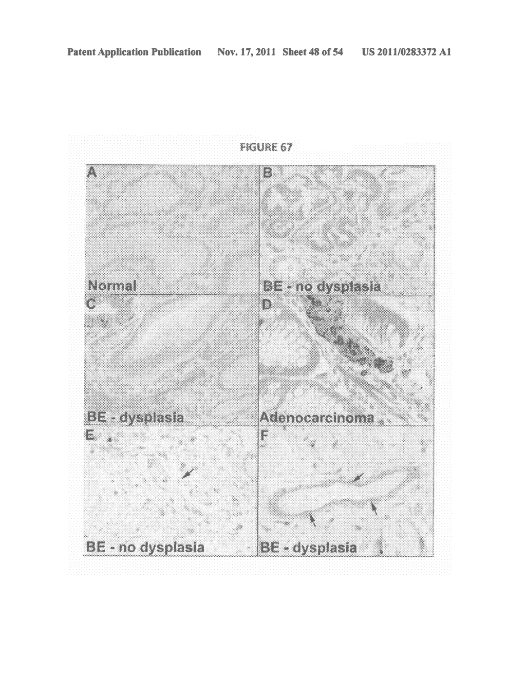 COMPOSITIONS USEFUL FOR CANCER DETECTION AND TREATMENT, A CANCER STEM CELL     MODEL, AND METHODS OF PRODUCTION AND USE THEREOF - diagram, schematic, and image 49