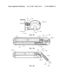 Medical Devices, Apparatuses, Systems, and Methods diagram and image