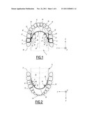 DENTAL APPLIANCE FOR CONSTRAINING THE TONGUE diagram and image