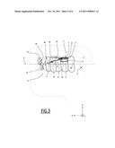 DENTAL APPLIANCE FOR CONSTRAINING THE TONGUE diagram and image