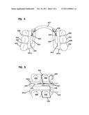 DENTAL APPLIANCE FOR CONSTRAINING THE TONGUE diagram and image