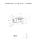 DENTAL APPLIANCE FOR CONSTRAINING THE TONGUE diagram and image