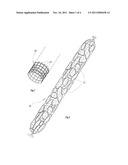 BIOLOGICAL FILTRATION SYSTEM WITH SOCKS OF ABSORBENT MATERIAL diagram and image