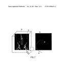 Visualization of Medical Image Data With Localized Enhancement diagram and image