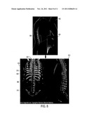 Visualization of Medical Image Data With Localized Enhancement diagram and image