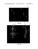 Visualization of Medical Image Data With Localized Enhancement diagram and image