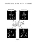 Visualization of Medical Image Data With Localized Enhancement diagram and image