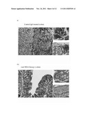 COMPOSITIONS AND METHODS FOR DIAGNOSING AND TREATING AN INFLAMMATION diagram and image