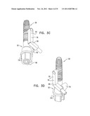 IMPLANTS, TOOLS, AND METHODS FOR SINUS LIFT AND LATERAL RIDGE AUGMENTATION diagram and image