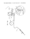 IMPLANTS, TOOLS, AND METHODS FOR SINUS LIFT AND LATERAL RIDGE AUGMENTATION diagram and image