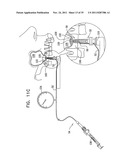 IMPLANTS, TOOLS, AND METHODS FOR SINUS LIFT AND LATERAL RIDGE AUGMENTATION diagram and image