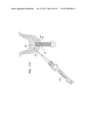 IMPLANTS, TOOLS, AND METHODS FOR SINUS LIFT AND LATERAL RIDGE AUGMENTATION diagram and image