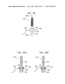 IMPLANTS, TOOLS, AND METHODS FOR SINUS LIFT AND LATERAL RIDGE AUGMENTATION diagram and image