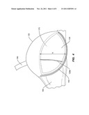 BREAST ENHANCING BRASSIERE diagram and image