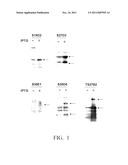 POLYPEPTIDE MARKER FOR DIAGNOSIS OF ARTERIOSCLEROSIS, METHOD FOR DETECTION     OF ARTERIOSCLEROSIS BY USING THE MAKER OR THE LIKE, AND KIT FOR DIAGNOSIS     OF ARTERIOSCLEROSIS diagram and image