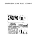 Methods for Preventing or Reducing Colon Carcinogenesis diagram and image