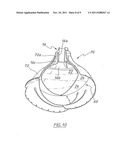 ACTUATOR FOR A HEART ASSIST DEVICE diagram and image