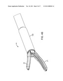 SURGICAL INSTRUMENT AND METHOD diagram and image