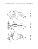 SURGICAL INSTRUMENT AND METHOD diagram and image