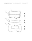 SURGICAL INSTRUMENT AND METHOD diagram and image