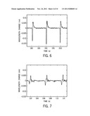 DEVICE, SYSTEM, AND METHOD FOR A STRESS SENSING MEDICAL NEEDLE diagram and image