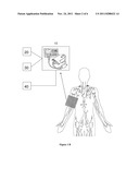 ESTIMATION OF PRESSURE AT REMOTE SITE BY BRACHIAL OSCILLOMETRIC WAVE FROM     ANALYSIS diagram and image