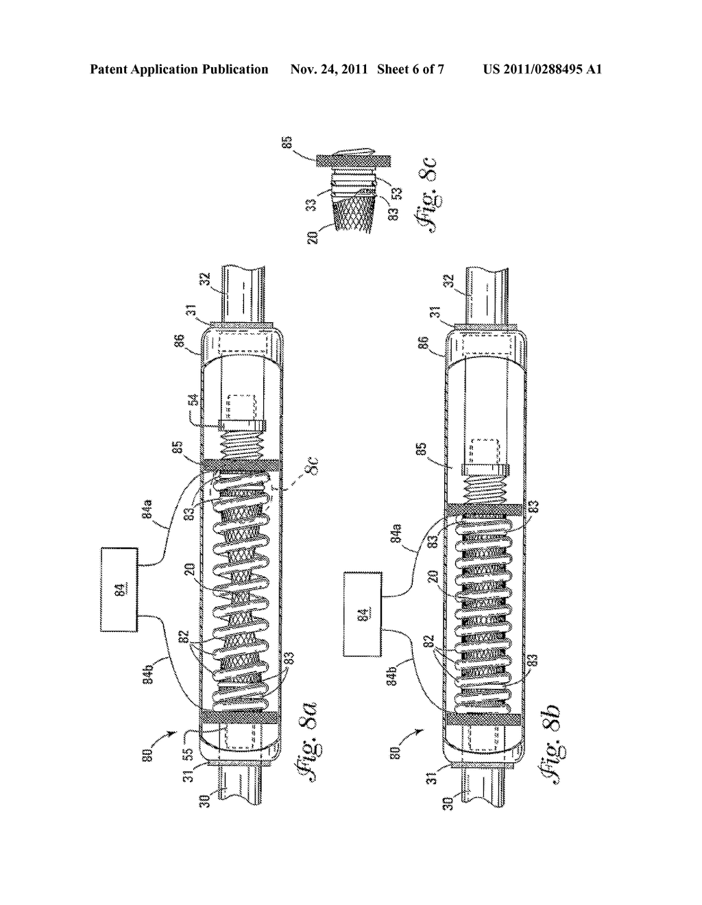 DIALYSIS VALVE AND METHOD - diagram, schematic, and image 07