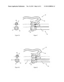 MEDICAL DEVICE FOR TISSUE ABLATION diagram and image