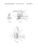 MEDICAL DEVICE FOR TISSUE ABLATION diagram and image