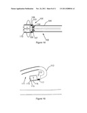 MEDICAL DEVICE FOR TISSUE ABLATION diagram and image