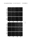 Method and Device for Ablation of Cancer and Resistance to New Cancer     Growth diagram and image