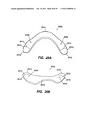 Apparatus for Sizing a Facet Joint diagram and image