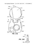 Apparatus for Sizing a Facet Joint diagram and image