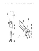 Apparatus for Sizing a Facet Joint diagram and image