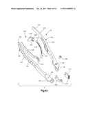 BONE FIXATION SYSTEMS AND METHODS OF USE diagram and image