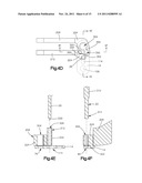 BONE FIXATION SYSTEMS AND METHODS OF USE diagram and image