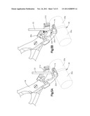 BONE FIXATION SYSTEMS AND METHODS OF USE diagram and image