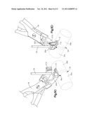 BONE FIXATION SYSTEMS AND METHODS OF USE diagram and image