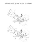 BONE FIXATION SYSTEMS AND METHODS OF USE diagram and image