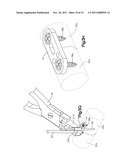 BONE FIXATION SYSTEMS AND METHODS OF USE diagram and image